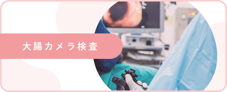 大腸カメラ検査（バナー）