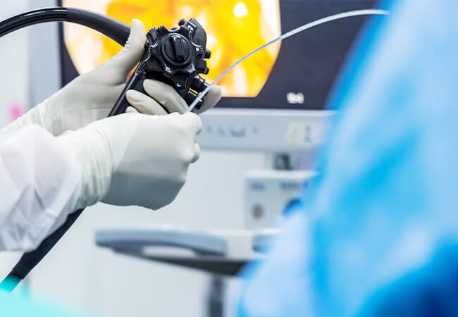 大腸カメラ検査でわかる疾患