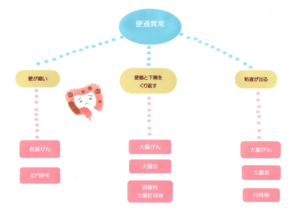 便通異常のイラスト図